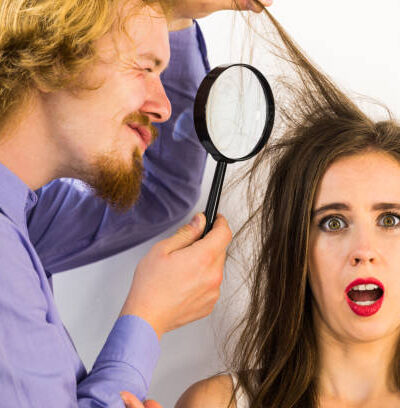 stinky hair and scalp issues
