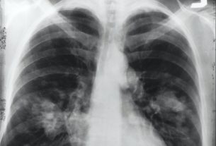 Lung Infection Symptoms